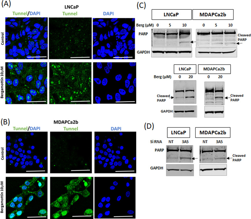 Bergamottin a CYP3A inhibitor found in grapefruit juice inhibits ...