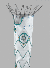 Cook p-Branch device with hinged, adaptive renal fenestration