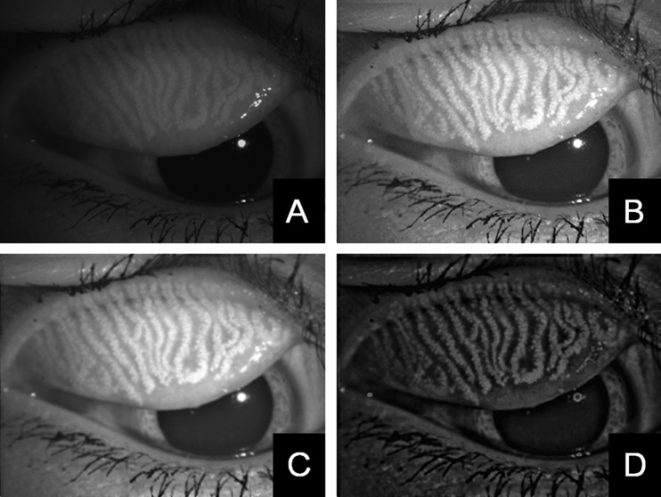 Figure 1