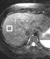 Figure 7a