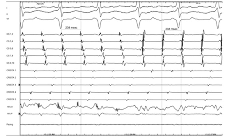 Figure 11.