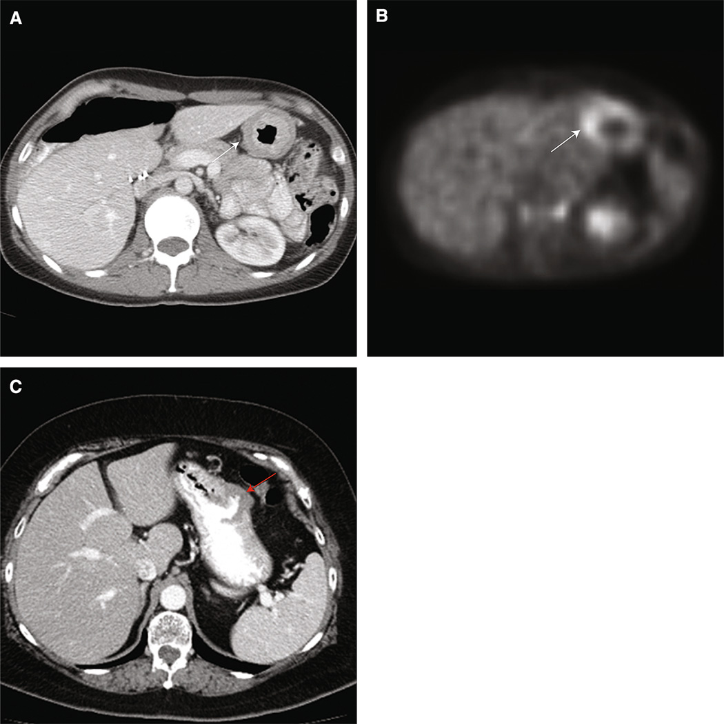 Fig. 11