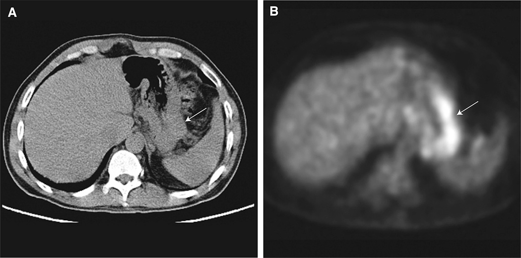 Fig. 12