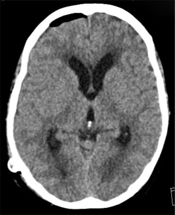 Figure 6: