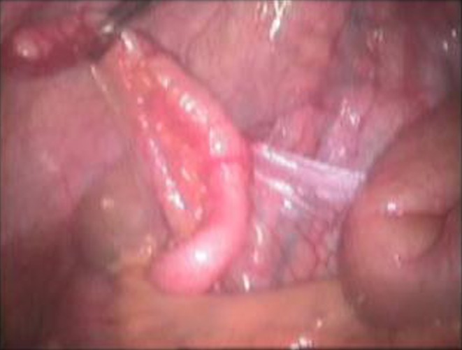 Fig. 2
