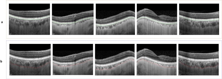 Figure 16