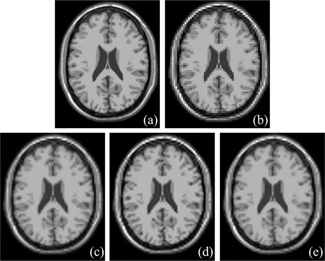 Fig. 12