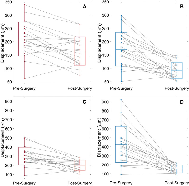 Box-and-whisker plots show mean and maximum peak displacement of (A, C) brainstem and (B, D) cerebellum for each of the 23 participants before and after surgery. Each line represents a participant. The center lines in the boxes represent the mean for each group, and the boxes represent the mean ± standard deviation. Whiskers represent the range of displacements for each group.