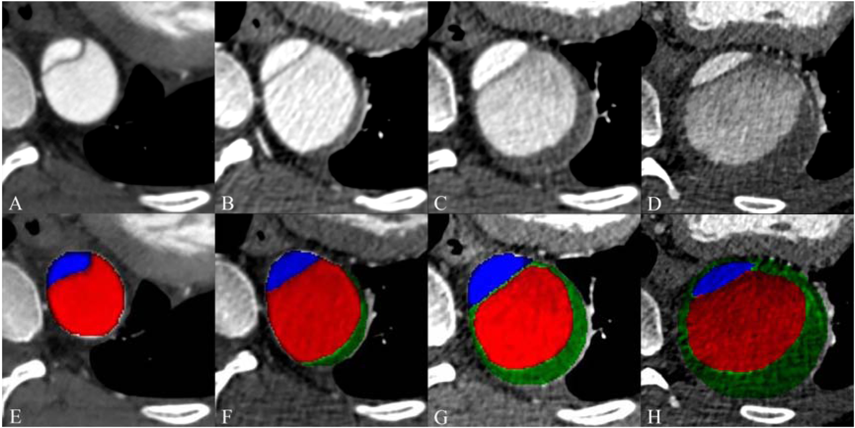 Figure 2: