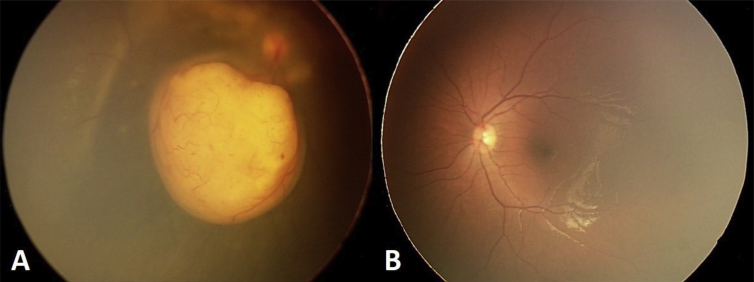 Fig. 1