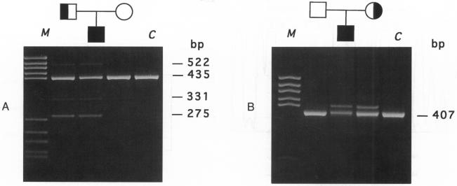 Figure 2A & B