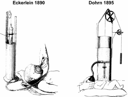 Fig. 1