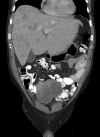 Fig. 1