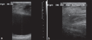 Figure 1(a, b)