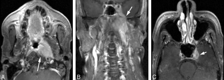 Fig 11.