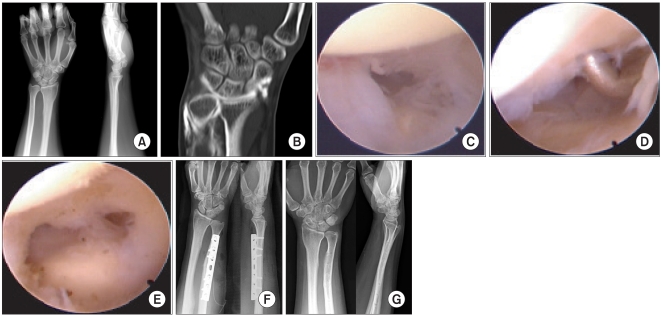 Fig. 2