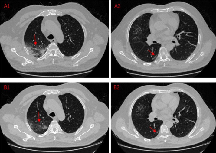 Fig 2