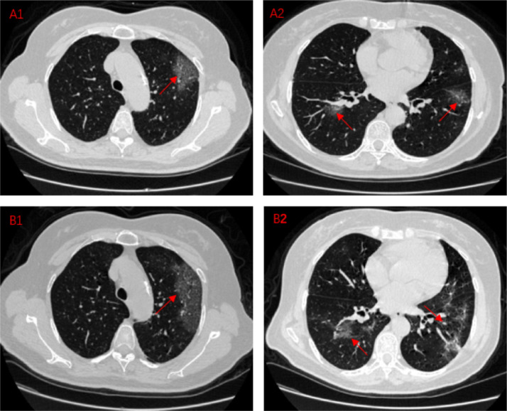 Fig 2