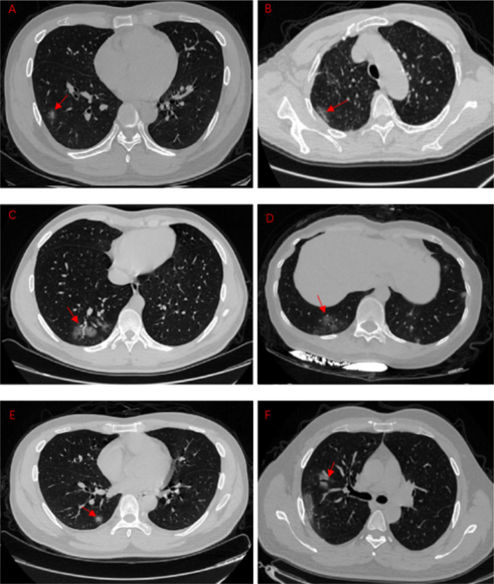 Fig 1