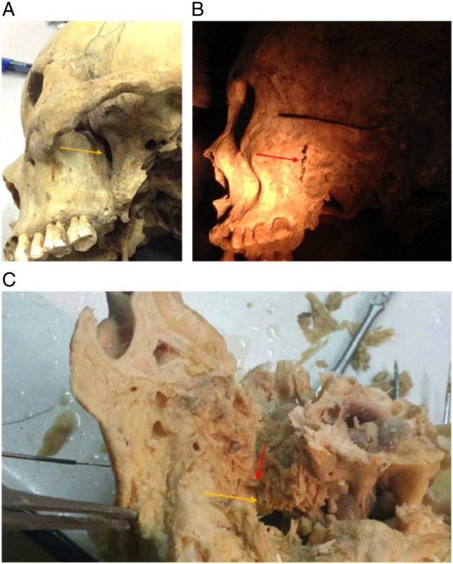 Figure 2