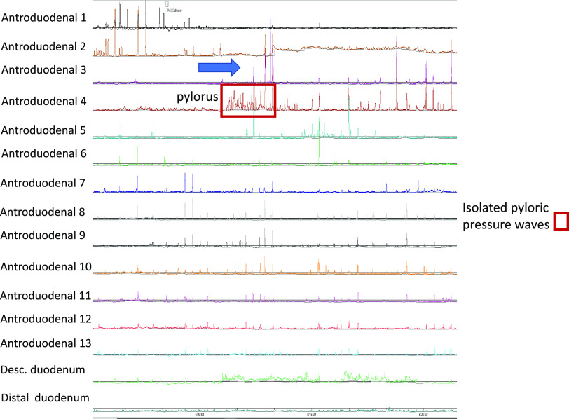 Figure 4.