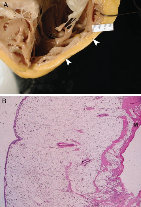 Figure 4)