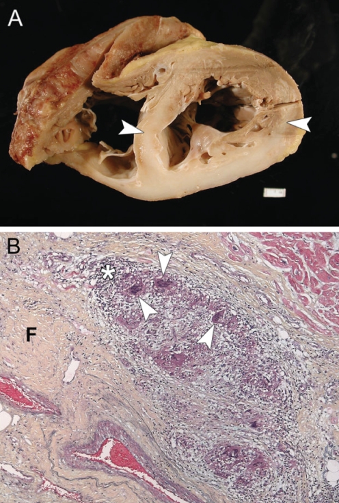 Figure 2)