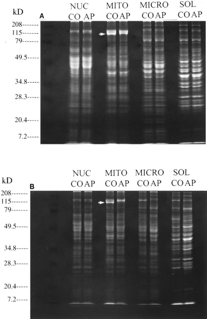 FIG. 1