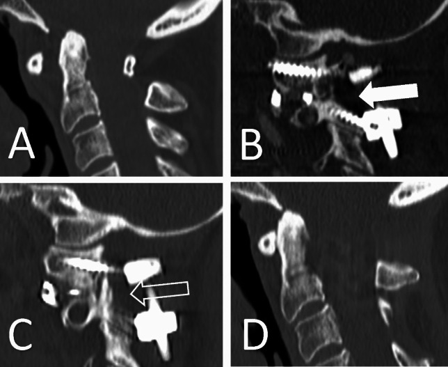 Fig. 3