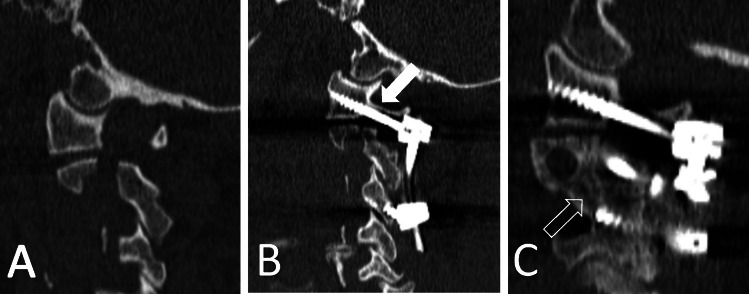 Fig. 2