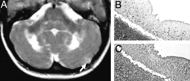 Fig 4.