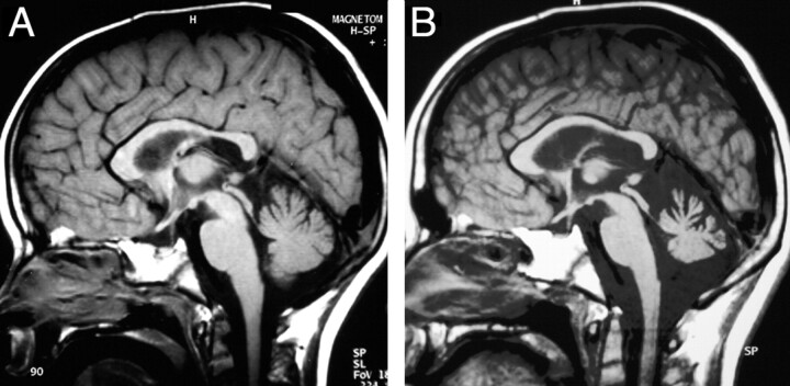 Fig 2.