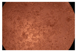 graphic file with name ijms-23-09382-i020.jpg