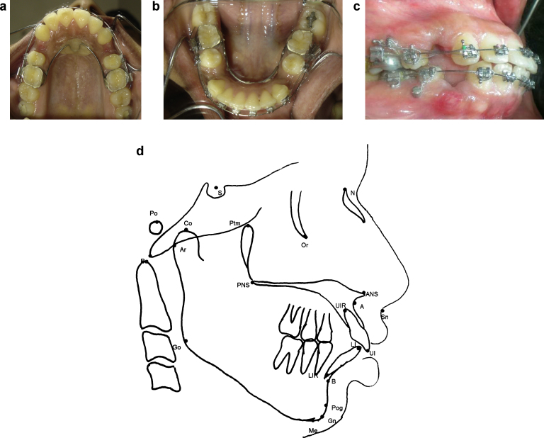 Fig. 1