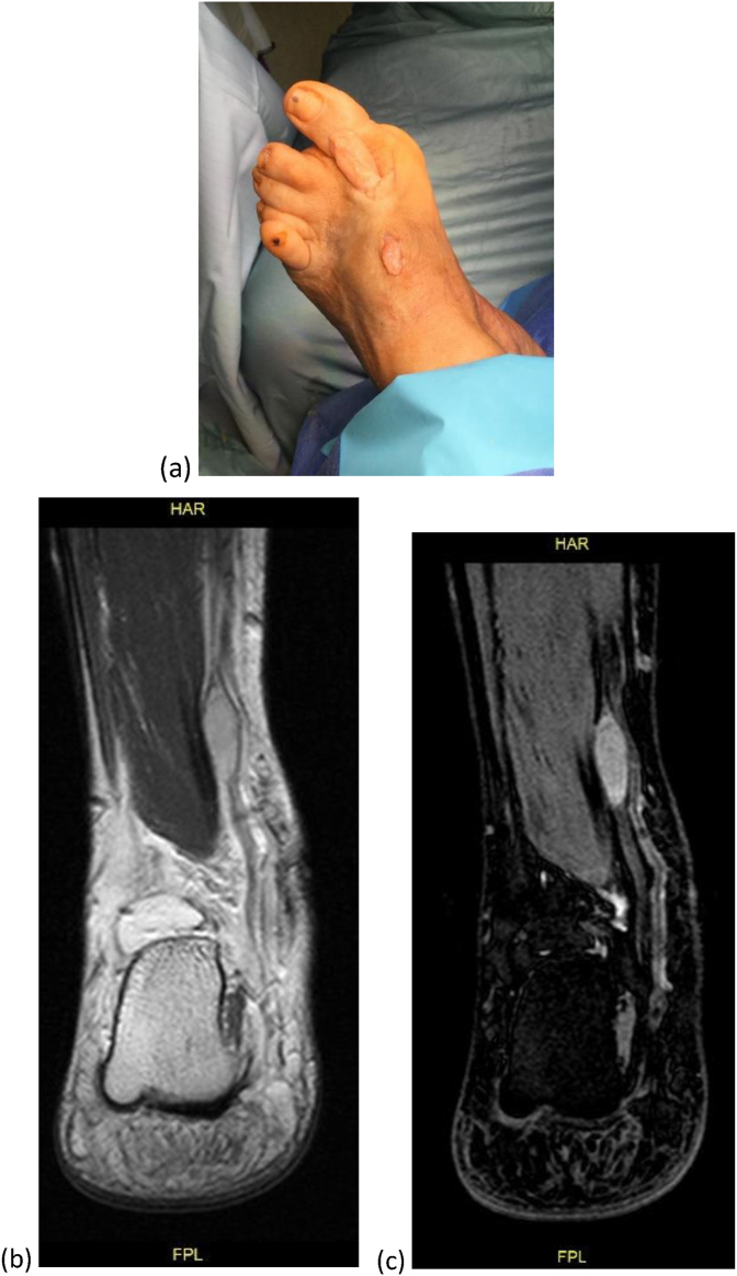 Fig. 3