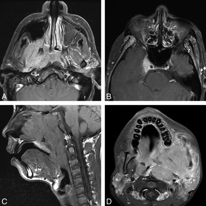 Fig 3.