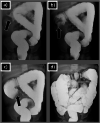 Fig. 2