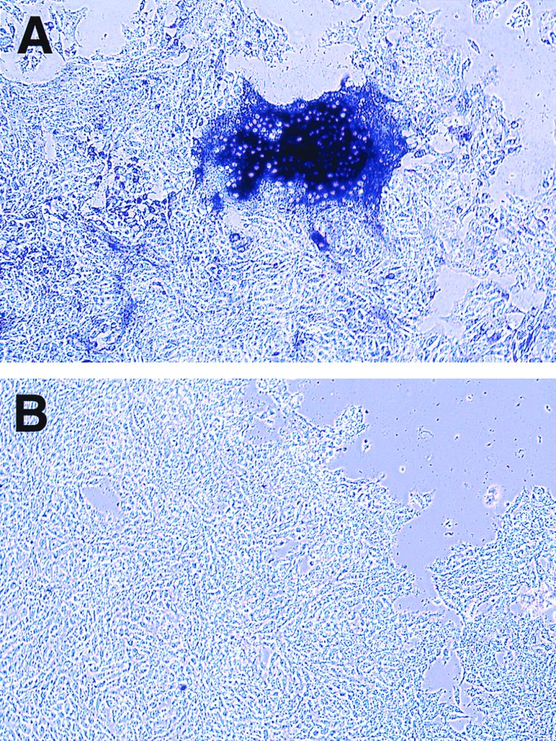 FIG. 5