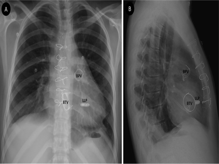 FIGURE 2