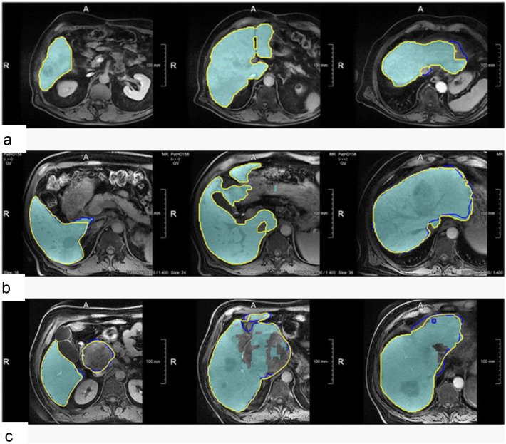 Fig. 7