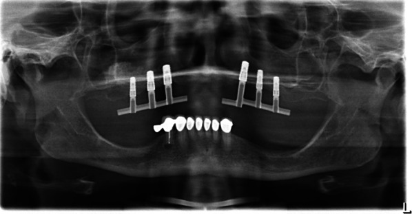 Fig. 7