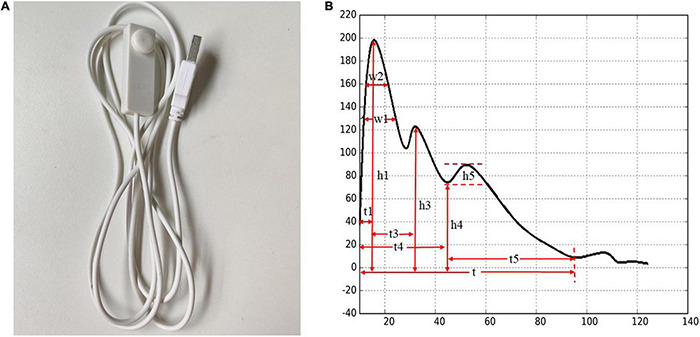 FIGURE 4