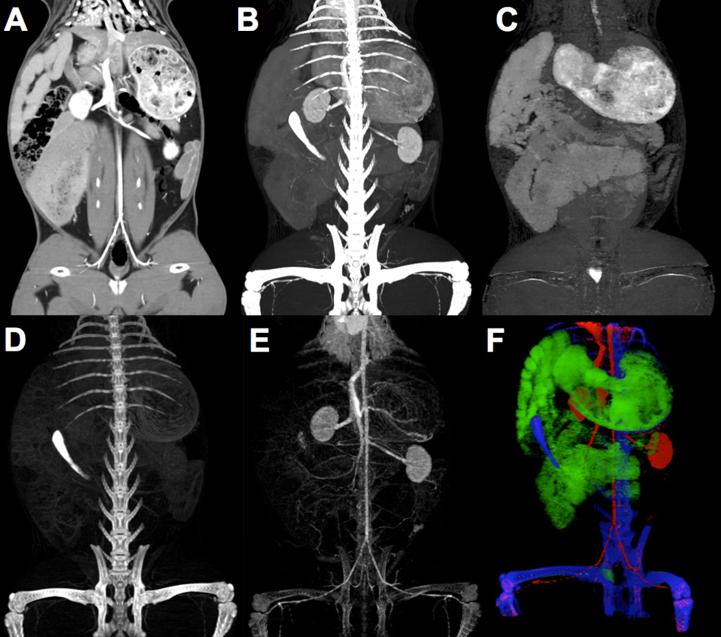 Figure 12