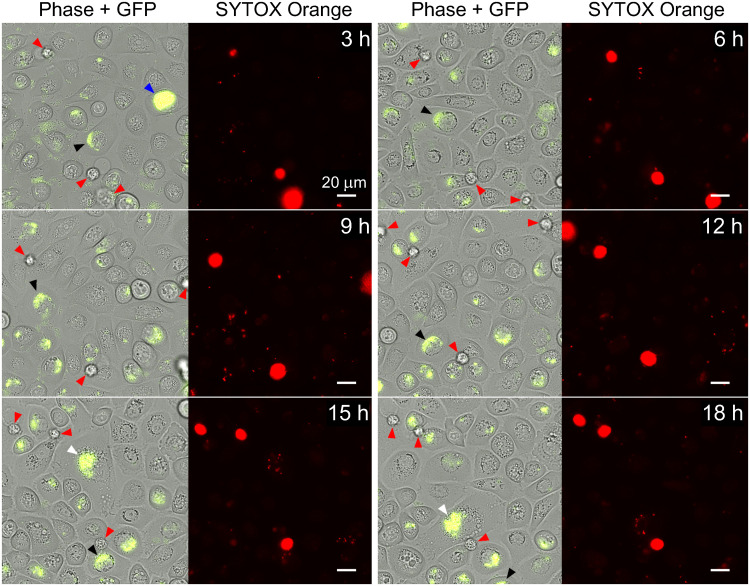 FIG 2