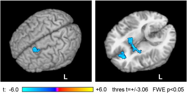 Fig. 11