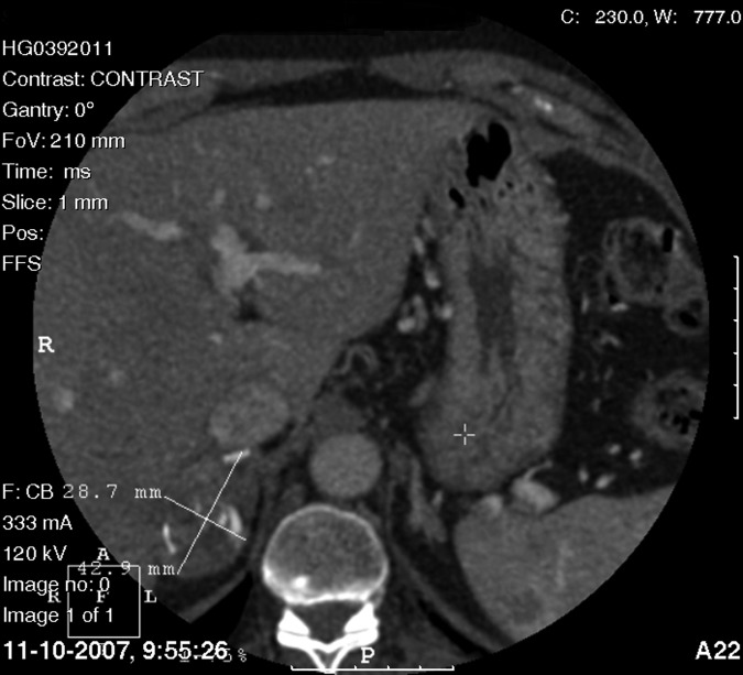 Figure 1