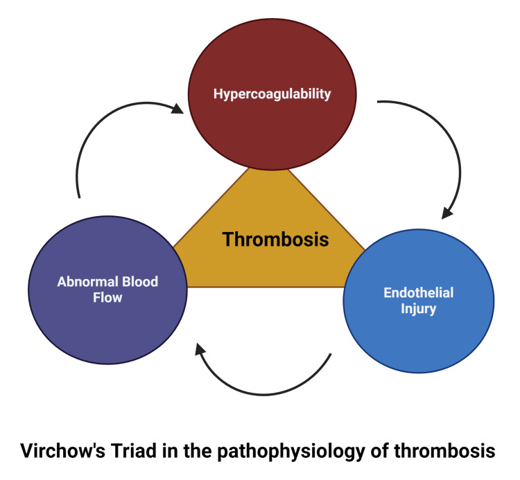 Transformative Deep Vein Thrombosis Prophylaxis With Sequential ...