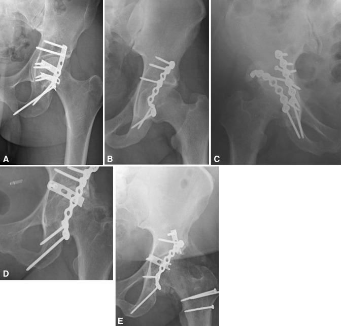 Fig. 1A–E