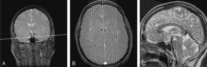 Fig 2.