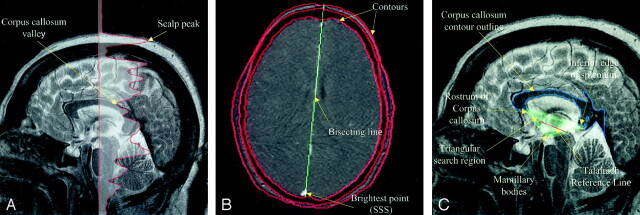 Fig 5.